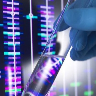 Rusia desarrolla un fármaco para el tratamiento de Parkinson