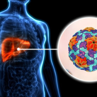 Implementan medidas para interrumpir transmisión de hepatitis en municipios de Matanzas