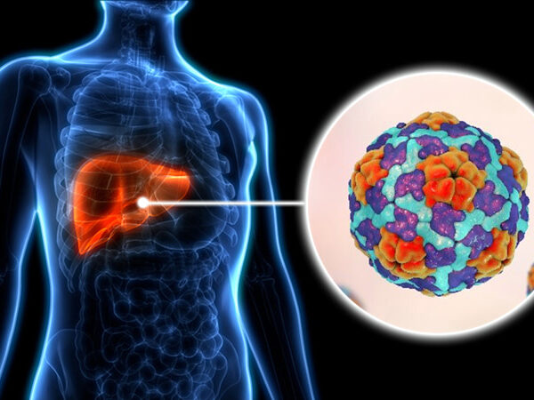 Implementan medidas para interrumpir transmisión de hepatitis en municipios de Matanzas